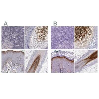 Immunohistochemistry-Paraffin: Gasdermin-A Antibody [NBP2-49426]