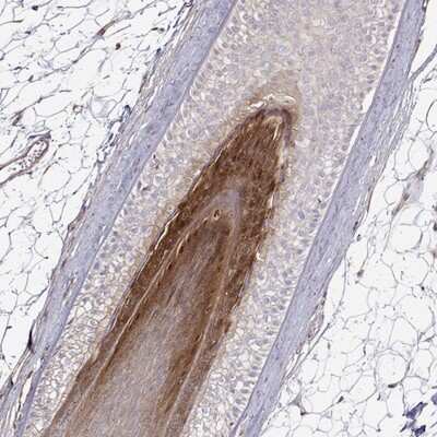Immunohistochemistry-Paraffin: Gasdermin-A Antibody [NBP2-49426]
