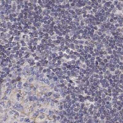Immunohistochemistry-Paraffin: Gasdermin-A Antibody [NBP2-49426]