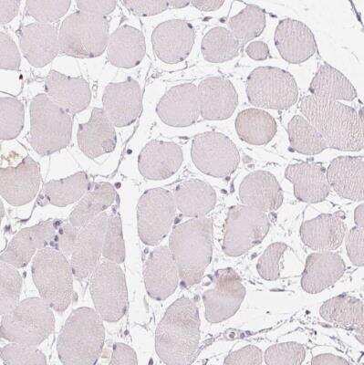 Immunohistochemistry-Paraffin: Gasdermin-C Antibody [NBP1-91926]