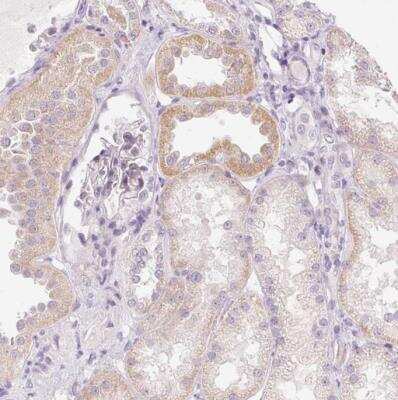 Immunohistochemistry-Paraffin: Gasdermin-C Antibody [NBP1-91926]
