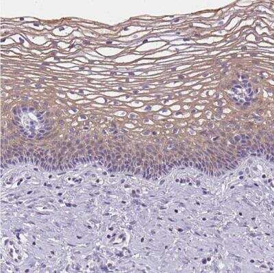 Immunohistochemistry-Paraffin: Gasdermin-C Antibody [NBP1-91926]