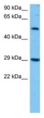 Western Blot: Gasdermin-C Antibody [NBP3-10217]