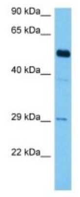 Western Blot: Gasdermin-C Antibody [NBP3-10234]