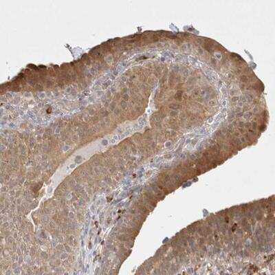 Immunohistochemistry: Gasdermin like Antibody [NBP1-91927]