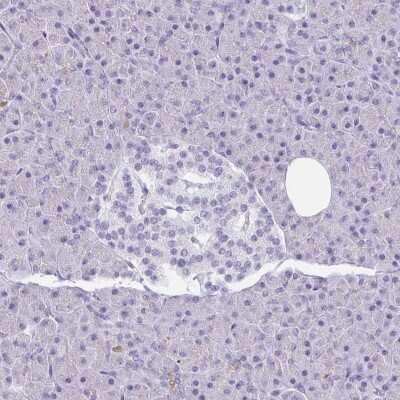 Immunohistochemistry-Paraffin: Gasdermin like Antibody [NBP2-33648]