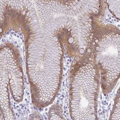 Immunohistochemistry-Paraffin: Gasdermin like Antibody [NBP2-33648]