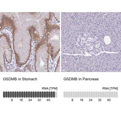 Immunohistochemistry-Paraffin: Gasdermin like Antibody [NBP2-33648]