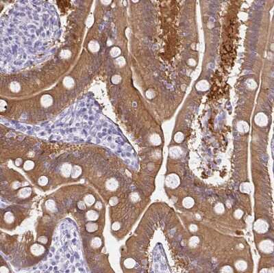 Immunohistochemistry-Paraffin: Gasdermin like Antibody [NBP2-33648]