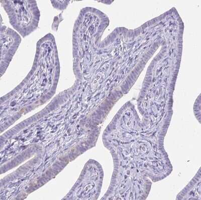 Immunohistochemistry-Paraffin: Gasdermin like Antibody [NBP2-33648]