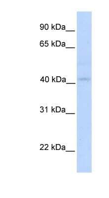 Western Blot: Gasdermin like Antibody [NBP1-54598]