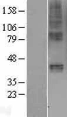 Western Blot: GIPR Overexpression Lysate [NBP2-04150]