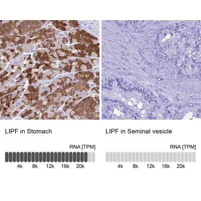 Immunohistochemistry-Paraffin: Gastric Lipase Antibody [NBP1-91928]