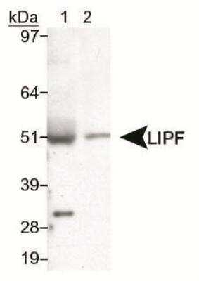 Western Blot: Gastric Lipase AntibodyBSA Free [NB110-60930]