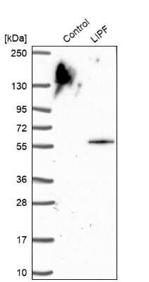 Western Blot: Gastric Lipase Antibody [NBP1-91928]