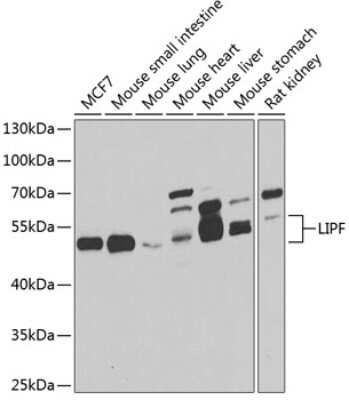 Western Blot: Gastric Lipase AntibodyBSA Free [NBP3-03578]