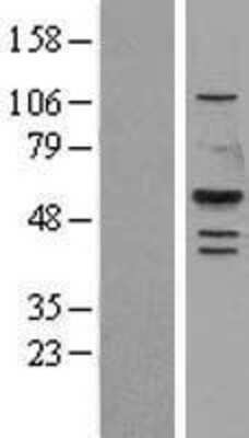 Western Blot: Gastric Lipase Overexpression Lysate [NBL1-12549]