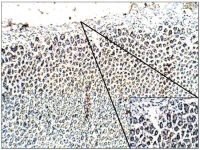 Immunohistochemistry-Paraffin: Gastrin Antibody [NBP3-12223]