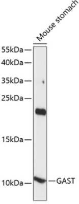 Western Blot: Gastrin AntibodyAzide and BSA Free [NBP3-02945]