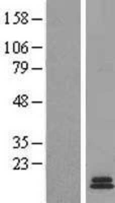 Western Blot: Gastrin Overexpression Lysate [NBL1-10978]