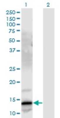 Western Blot: Gastrin-releasing Peptide/Bombesin/Neuromedin C Antibody (3A11) [H00002922-M03]