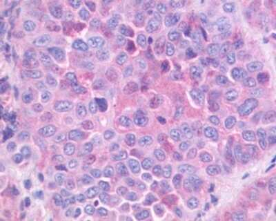 Immunohistochemistry-Paraffin: Gastrin-releasing Peptide R/GRPR Antibody - BSA Free [NLS830]