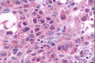Immunohistochemistry-Paraffin: Gastrin-releasing Peptide R/GRPR Antibody - BSA Free [NLS830]