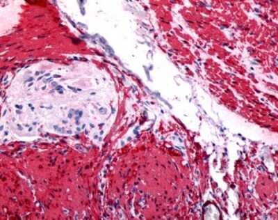 Immunohistochemistry-Paraffin: Gastrin-releasing Peptide R/GRPR Antibody - BSA Free [NLS831]