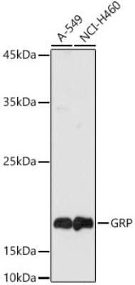 Western Blot: Gastrin-releasing Peptide/Bombesin/Neuromedin C AntibodyBSA Free [NBP3-03282]