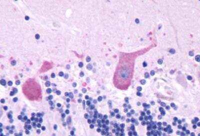 Immunohistochemistry-Paraffin: Gastrin-releasing Peptide R/GRPR Antibody - BSA Free [NLS830]