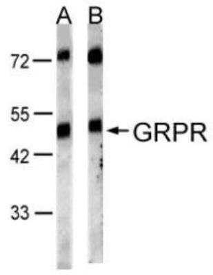 Western Blot: Gastrin-releasing Peptide R/GRPR Antibody [NBP1-30937]