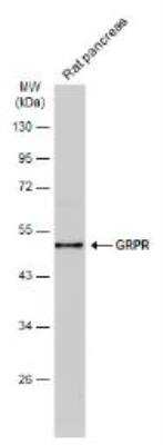 Western Blot: Gastrin-releasing Peptide R/GRPR Antibody [NBP1-30937]