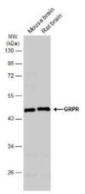Western Blot: Gastrin-releasing Peptide R/GRPR Antibody [NBP1-30937]