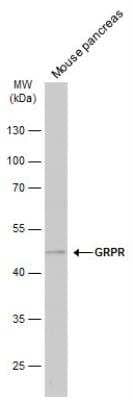 Western Blot: Gastrin-releasing Peptide R/GRPR Antibody [NBP1-30937]