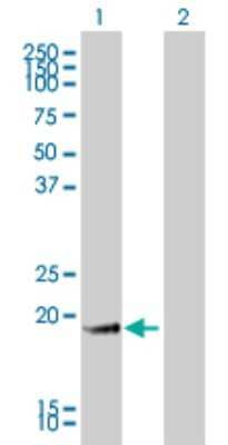 Western Blot: Gastrokine 1 Antibody (2E5) [H00056287-M01]