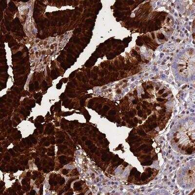 Immunohistochemistry-Paraffin: Gastrokine 1 Antibody [NBP2-14052]