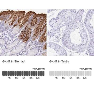 Immunohistochemistry-Paraffin: Gastrokine 1 Antibody [NBP2-14052]