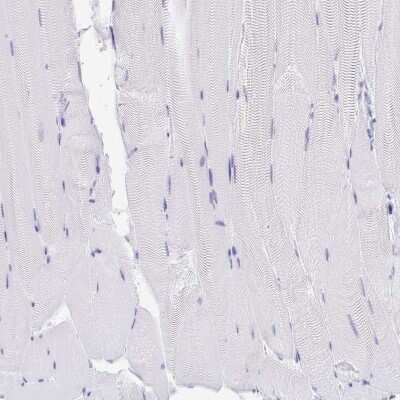 Immunohistochemistry-Paraffin: Gastrokine 1 Antibody [NBP2-14052]