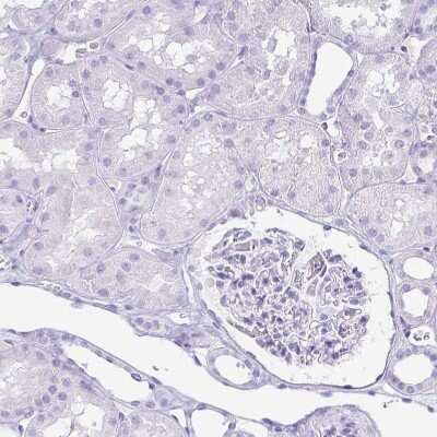 Immunohistochemistry-Paraffin: Gastrokine 1 Antibody [NBP2-14052]