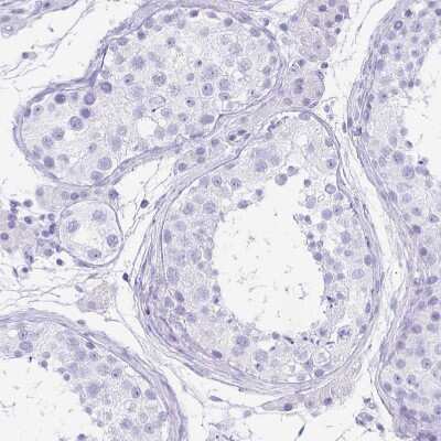 Immunohistochemistry-Paraffin: Gastrokine 1 Antibody [NBP2-14052]
