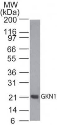 Western Blot: Gastrokine 1 Antibody [NBP2-24766]