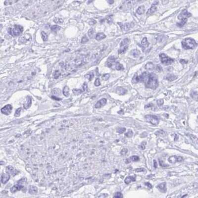 Immunohistochemistry: Gastrokine 2 Antibody [NBP2-31688]