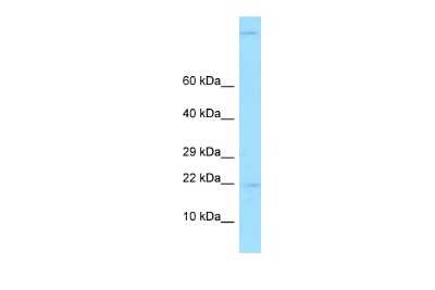 Western Blot: Gastrokine 2 Antibody [NBP2-82885]