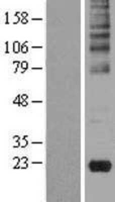 Western Blot: Gastrokine 2 Overexpression Lysate [NBL1-11103]