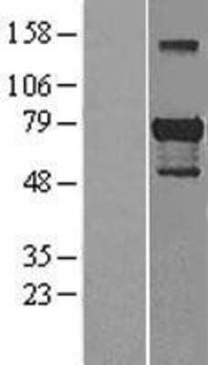 Western Blot: GATA-6 Overexpression Lysate [NBL1-10984]