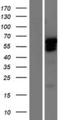 Western Blot: GBX2 Overexpression Lysate [NBP2-08203]