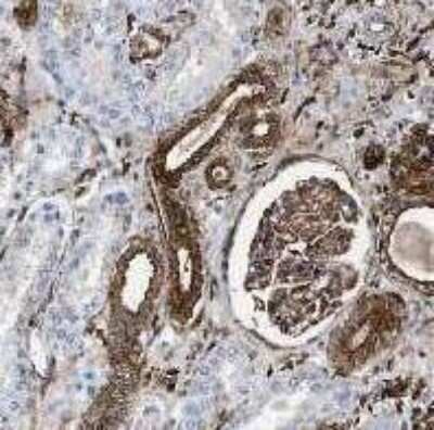 Immunohistochemistry-Paraffin: Gelsolin/GSN Antibody (20) - BSA Free [NBP1-05161]