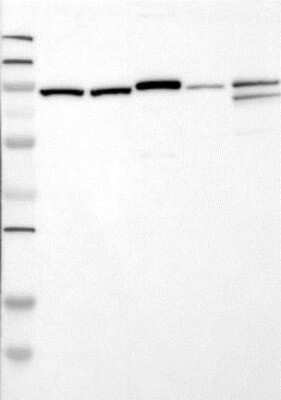 Western Blot: Gelsolin/GSN Antibody (20)BSA Free [NBP1-05161]