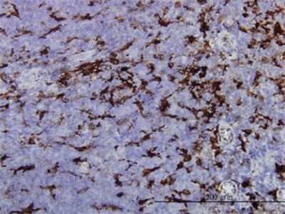 Immunohistochemistry-Paraffin: Gelsolin/GSN Antibody (3G5) [H00002934-M01]