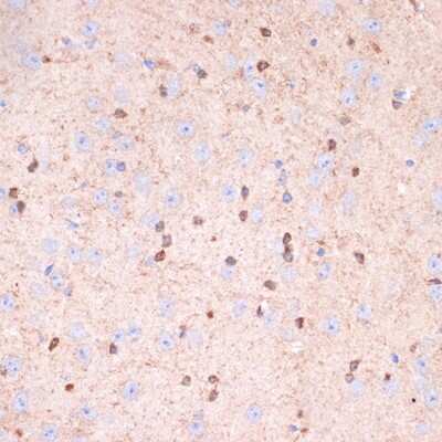 Immunohistochemistry-Paraffin: Gelsolin/GSN Antibody (5O10O1) [NBP3-16138]